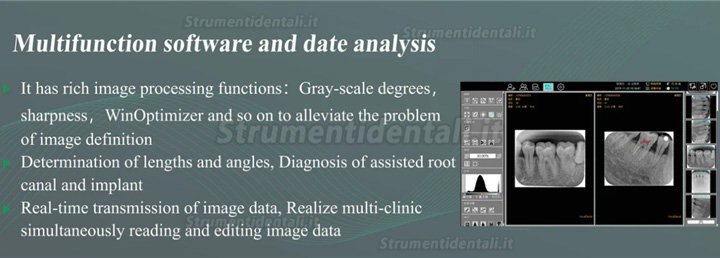 TYRIS CR-100 radiografia digitale ai fosfori sistema di elaborazione della scansione dentale